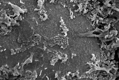 Scanning electron microscope image showing bacterial contamination on an uncleaned razor surface