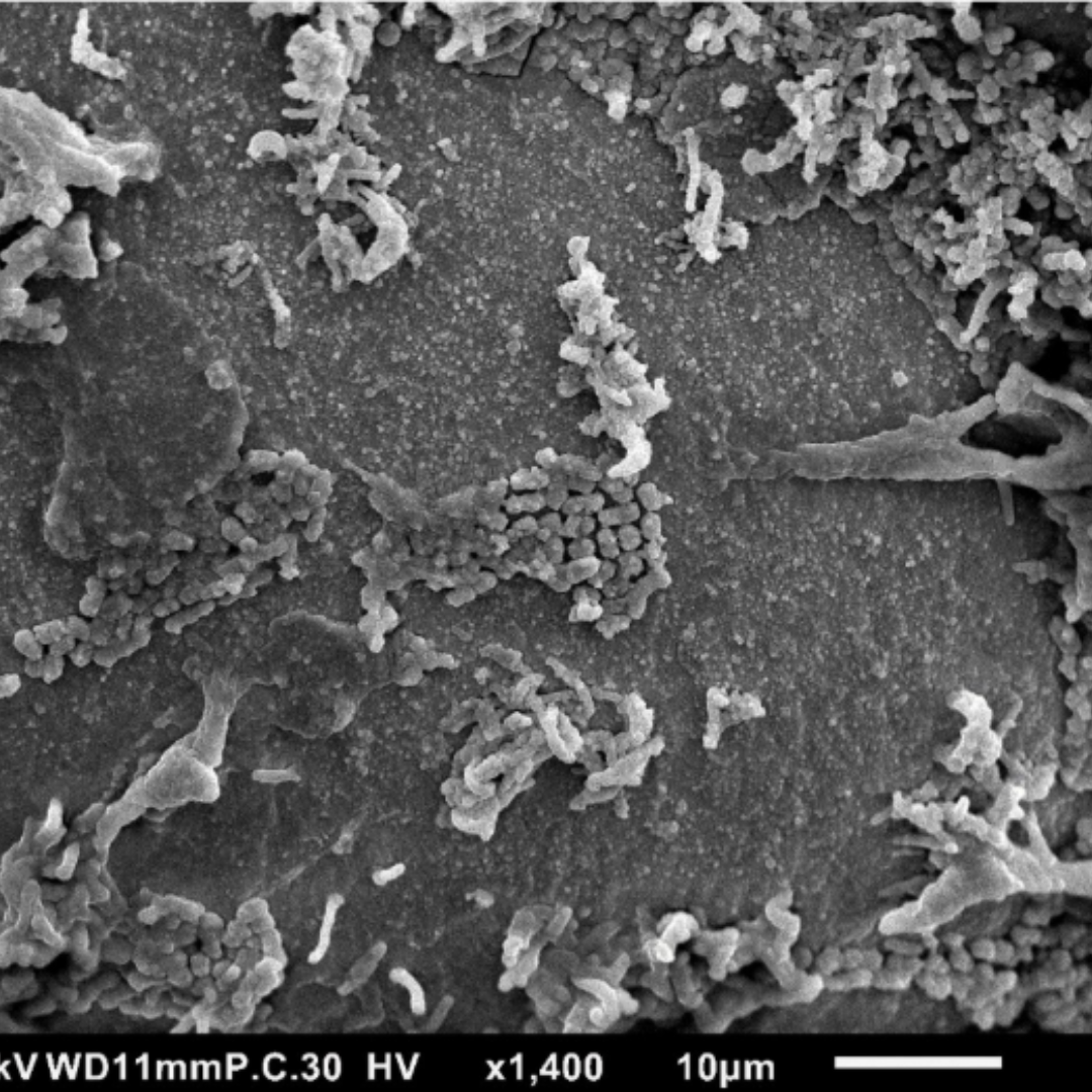 High-magnification SEM image showing bacterial contamination on an uncleaned razor surface